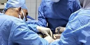 إنقاذ مريض من تسمم دموي وإجراء 11 جراحة دقيقة بمستشفى المنيا
