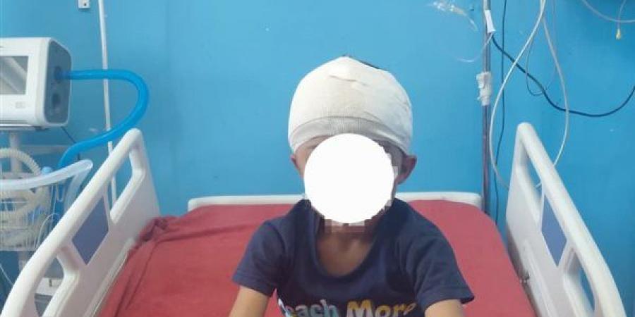 معجزة طبية في سوهاج، استخراج رصاصة من مخ طفل وإنقاذه دون مضاعفات