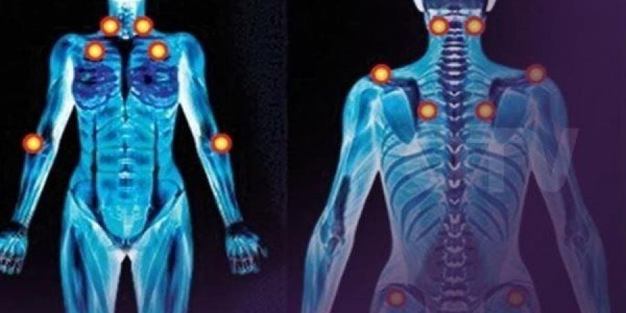 10 نصائح تساعد فى علاج مرض الفايبروميالجيا